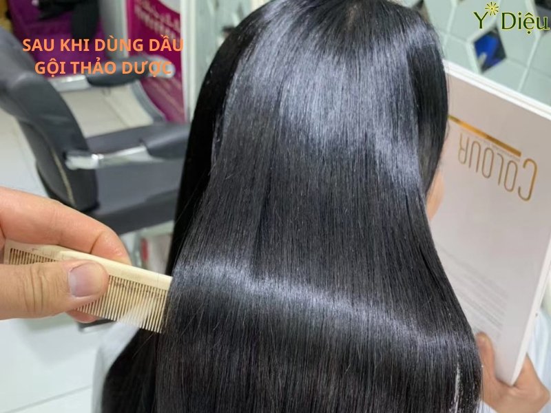 Dầu gội thảo dược mọc tóc là một liệu pháp chăm sóc toàn diện